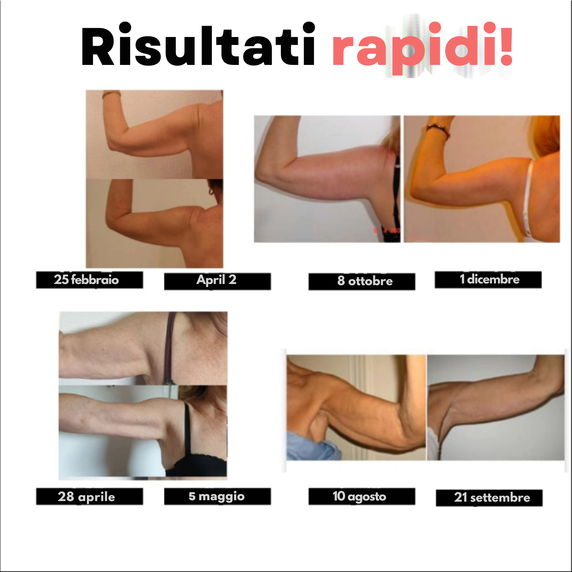 FittaBella 3D Sculpting Sleeves - Niente più braccia flaccide